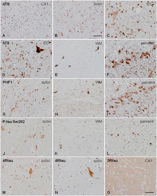 Capacity for Seeding and Spreading of Argyrophilic Grain Disease in a Wild-Type Murine Model; Comparisons With Primary Age-Related Tauopathy